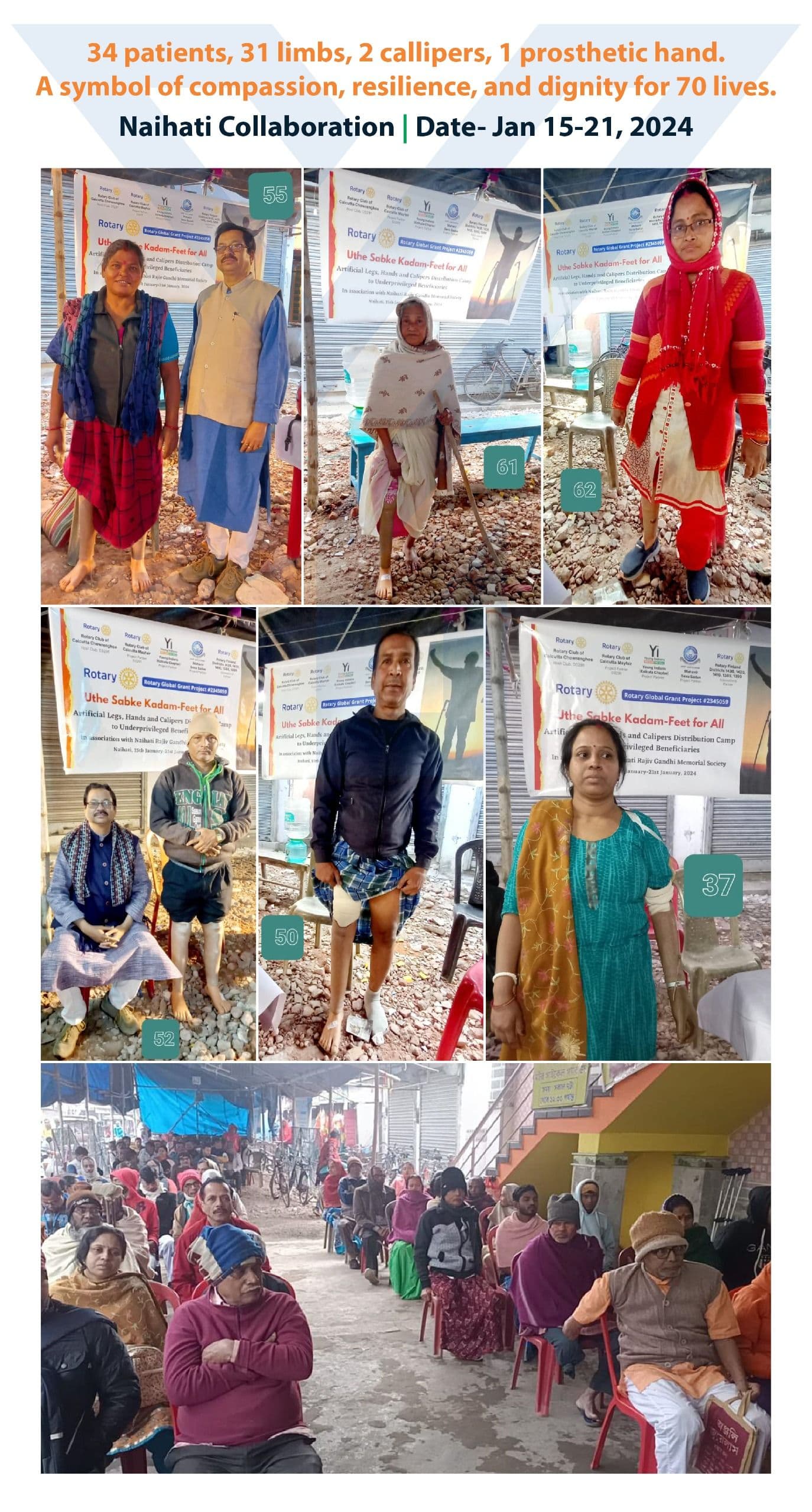 Yi24 | Accessibility - Prosthetic Hands and Legs